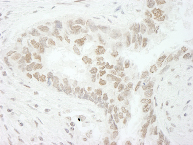 PAF49 Antibody in Immunohistochemistry (IHC)