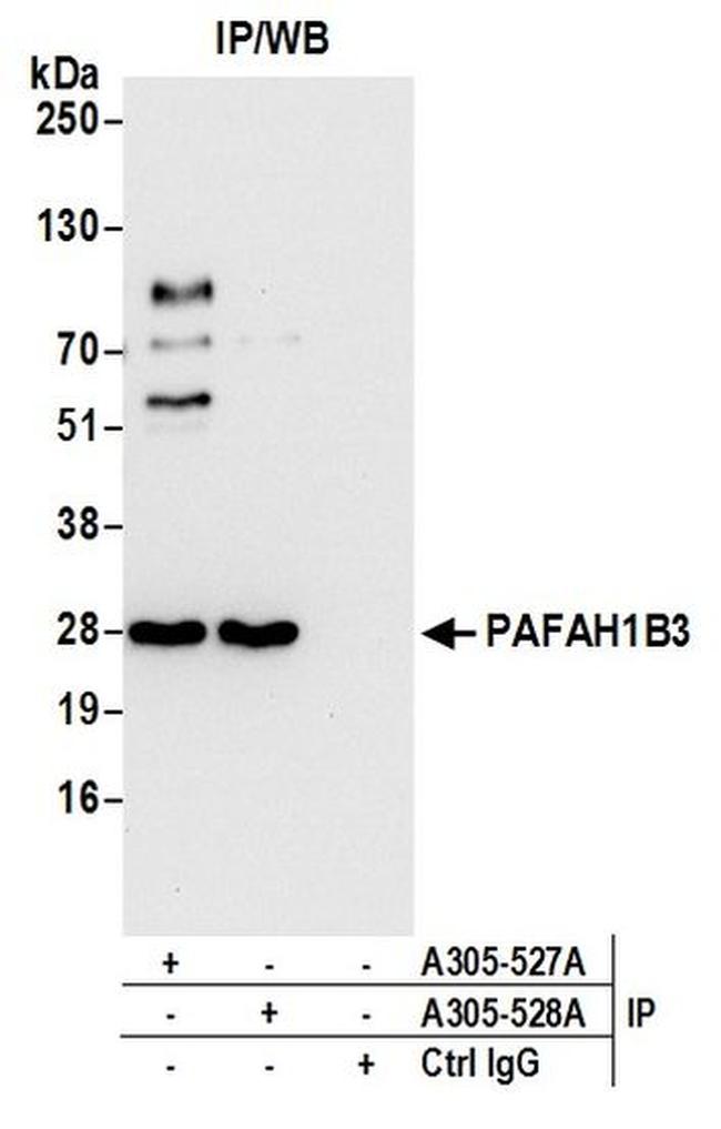 PAFAH1B3 Antibody in Western Blot (WB)