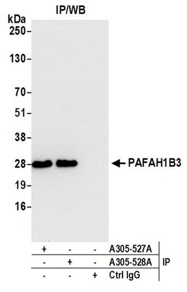 PAFAH1B3 Antibody in Western Blot (WB)