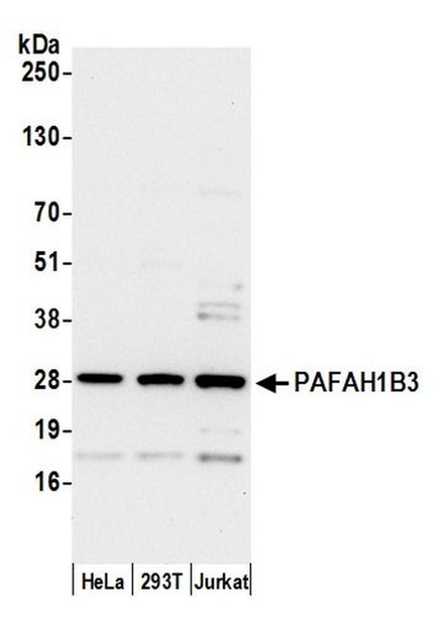 PAFAH1B3 Antibody in Western Blot (WB)