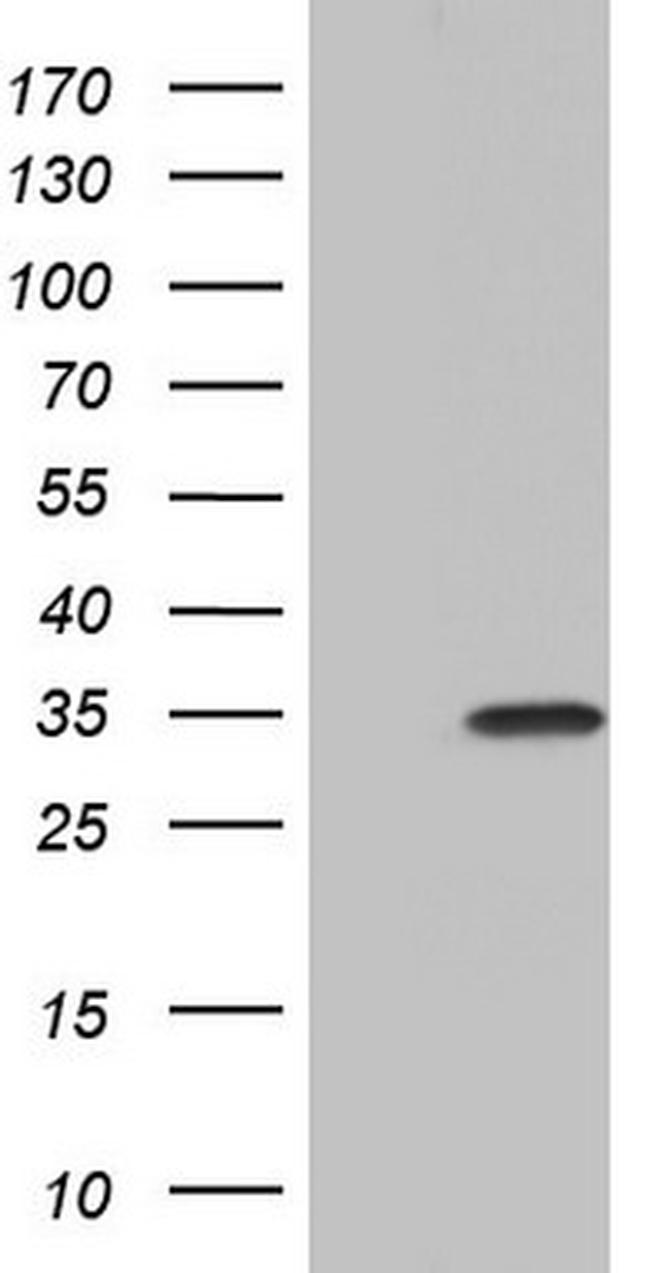 PAFAH1B3 Antibody in Western Blot (WB)