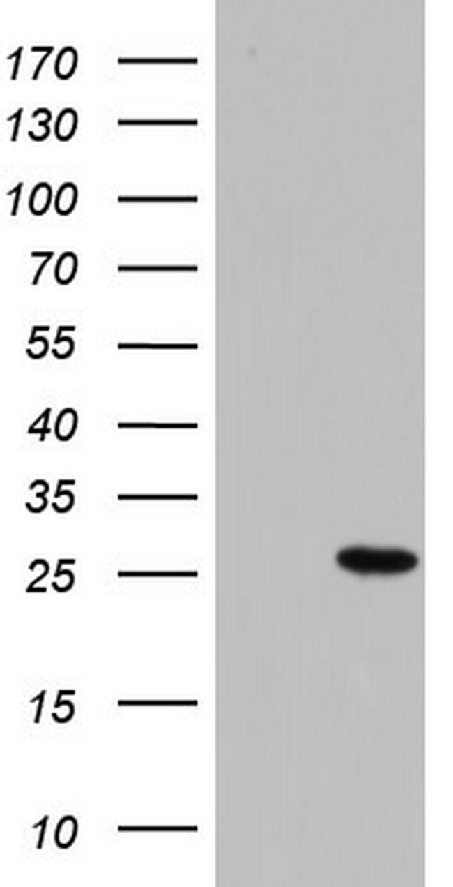 PAFAH1B3 Antibody in Western Blot (WB)