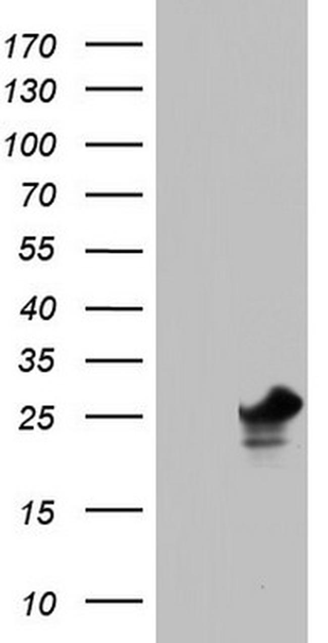 PAFAH1B3 Antibody in Western Blot (WB)