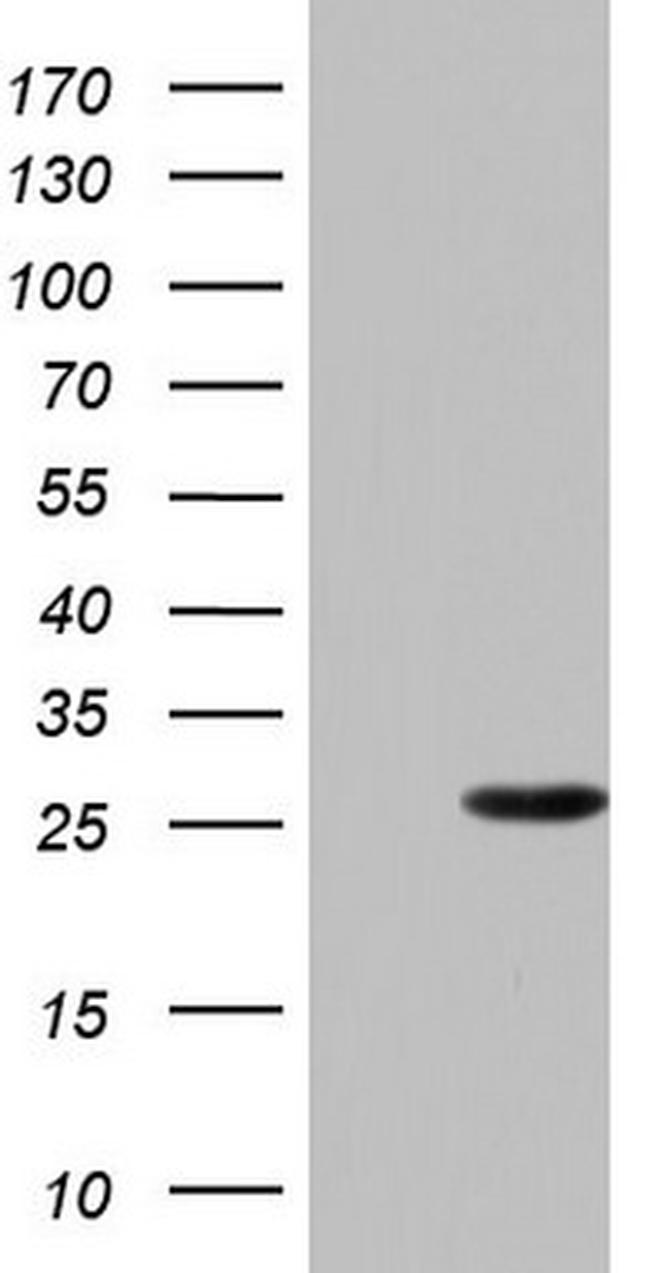 PAFAH1B3 Antibody in Western Blot (WB)