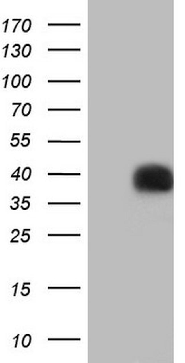 PAGE1 Antibody in Western Blot (WB)