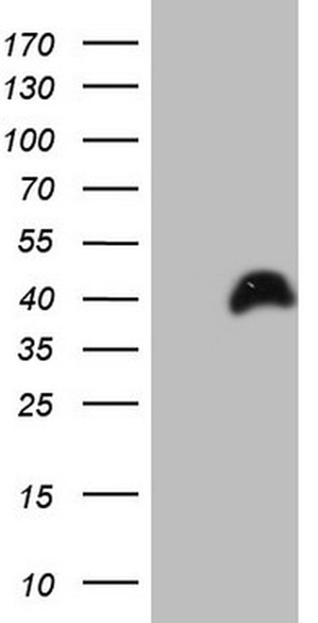 PAGE1 Antibody in Western Blot (WB)
