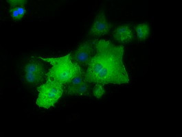 PAICS Antibody in Immunocytochemistry (ICC/IF)