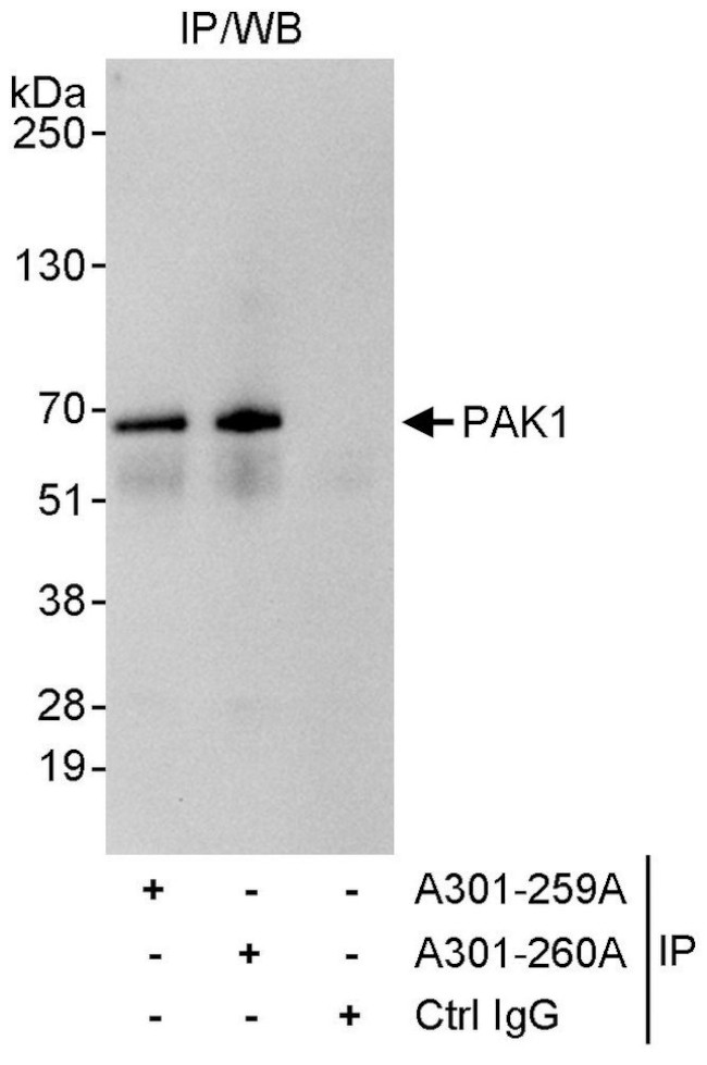 PAK1 Antibody in Immunoprecipitation (IP)