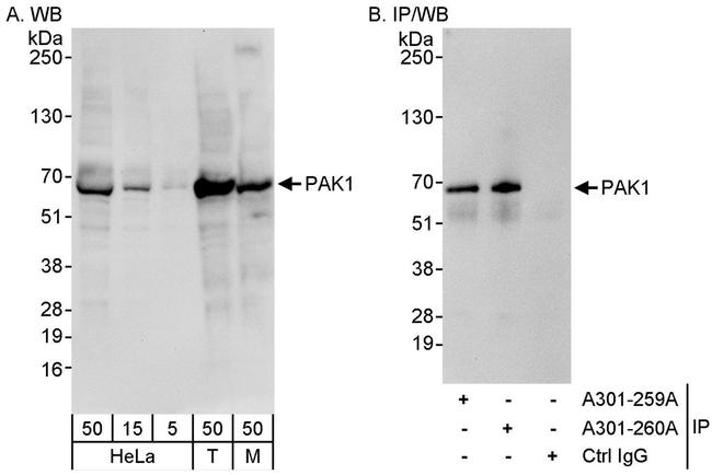 PAK1 Antibody in Western Blot (WB)