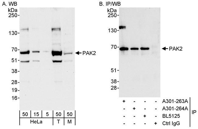 PAK2 Antibody in Western Blot (WB)