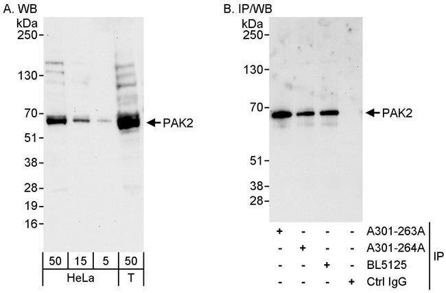 PAK2 Antibody in Western Blot (WB)