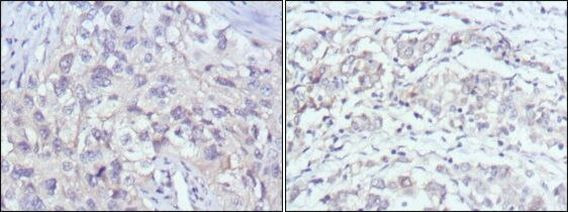 PAK2 Antibody in Immunohistochemistry (Paraffin) (IHC (P))