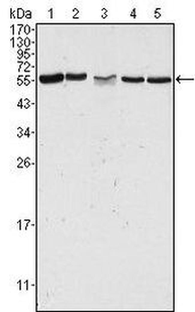 PAK2 Antibody in Western Blot (WB)