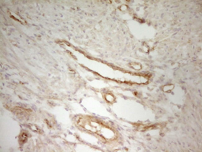 PAK4 Antibody in Immunohistochemistry (Paraffin) (IHC (P))