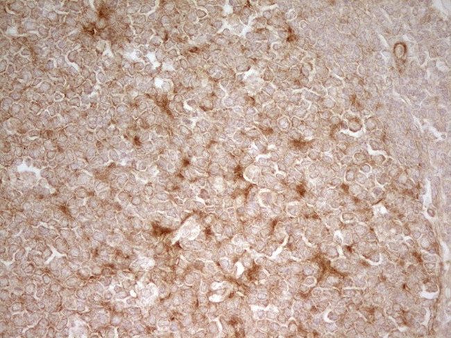 PAK4 Antibody in Immunohistochemistry (Paraffin) (IHC (P))