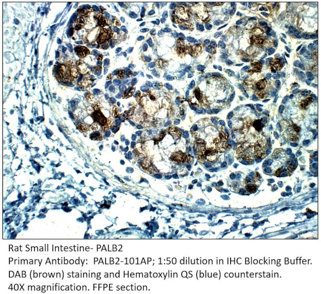 PALB2 Antibody in Immunohistochemistry (IHC)