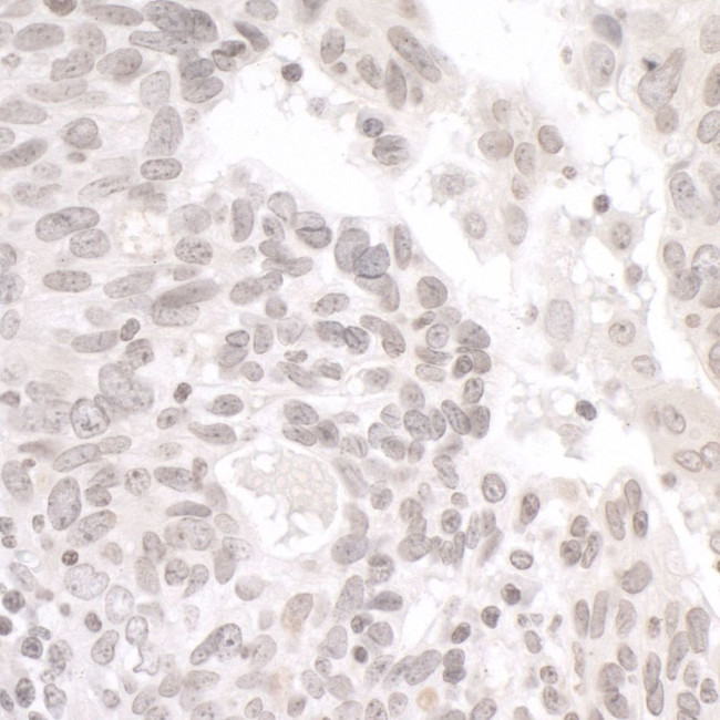 PALB2 Antibody in Immunohistochemistry (IHC)