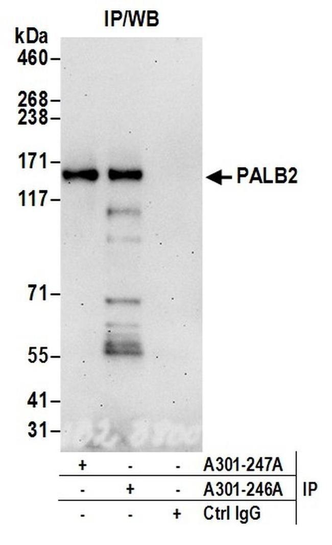 PALB2 Antibody in Western Blot (WB)