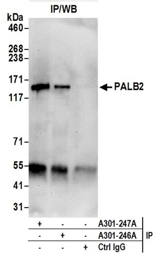 PALB2 Antibody in Western Blot (WB)