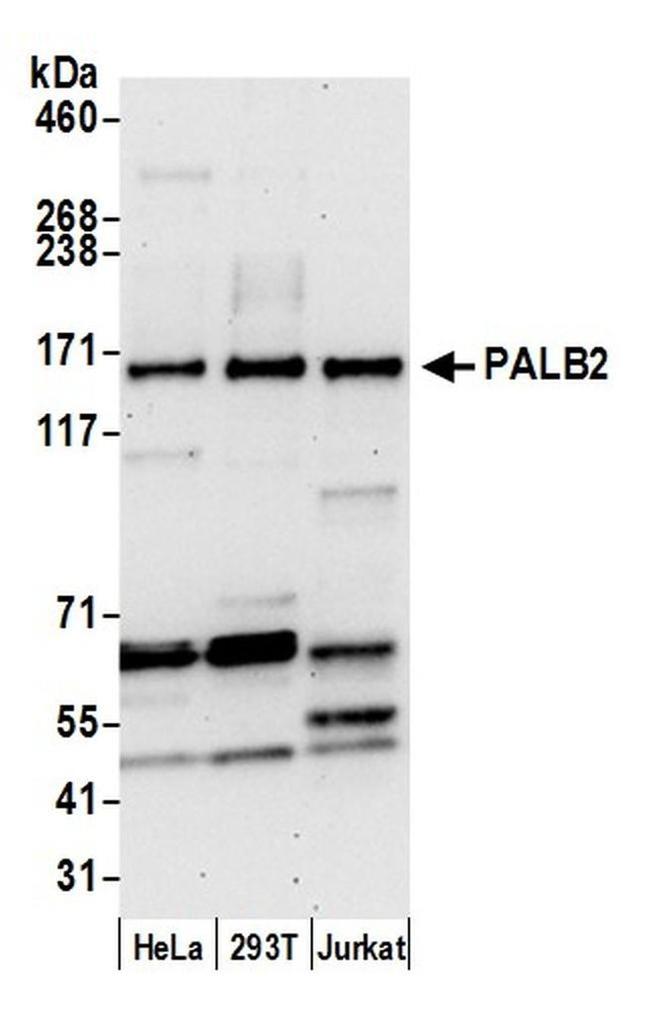 PALB2 Antibody in Western Blot (WB)