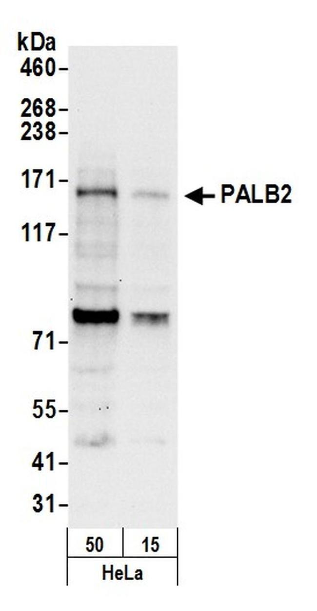 PALB2 Antibody in Western Blot (WB)