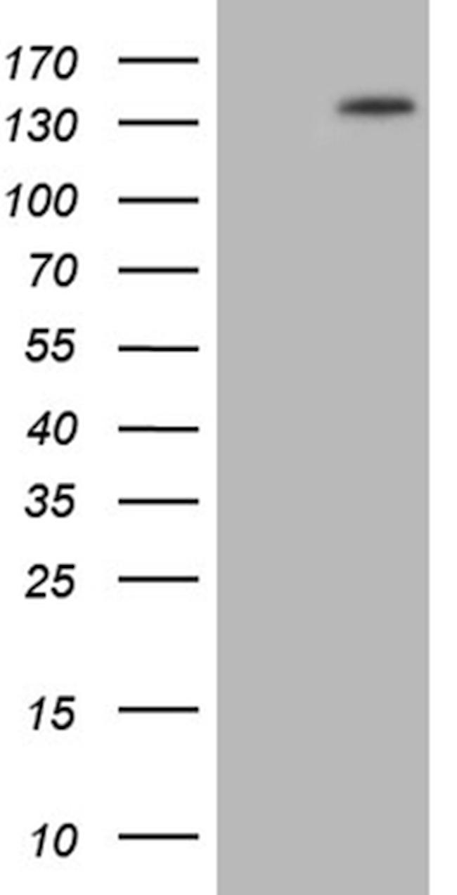 PALB2 Antibody in Western Blot (WB)