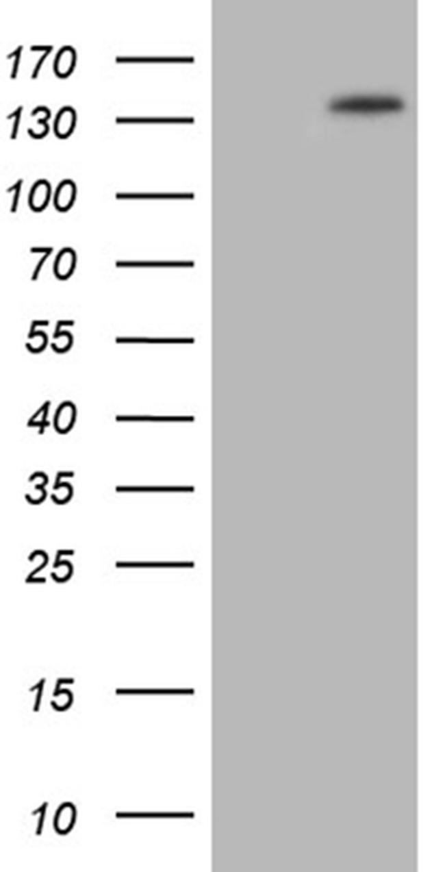 PALB2 Antibody in Western Blot (WB)