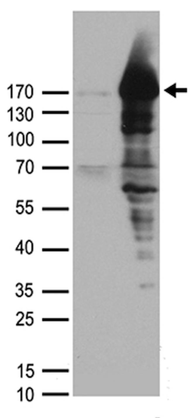 PALB2 Antibody in Western Blot (WB)