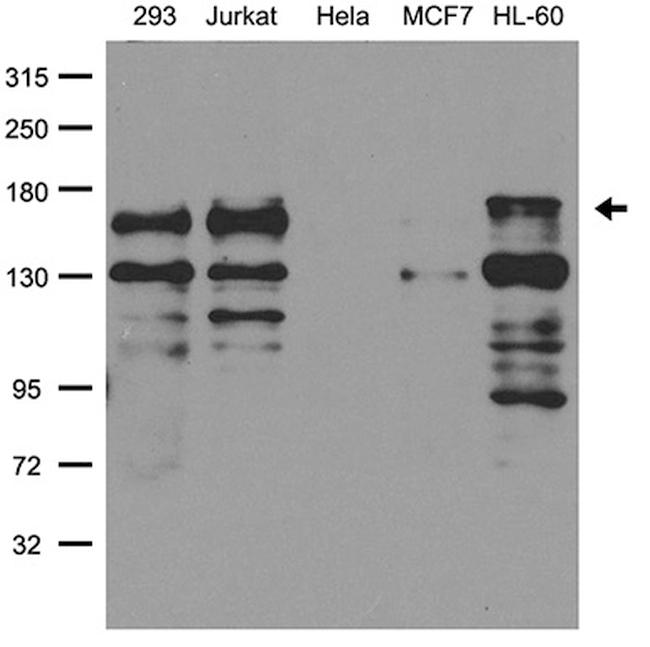 PALB2 Antibody in Western Blot (WB)