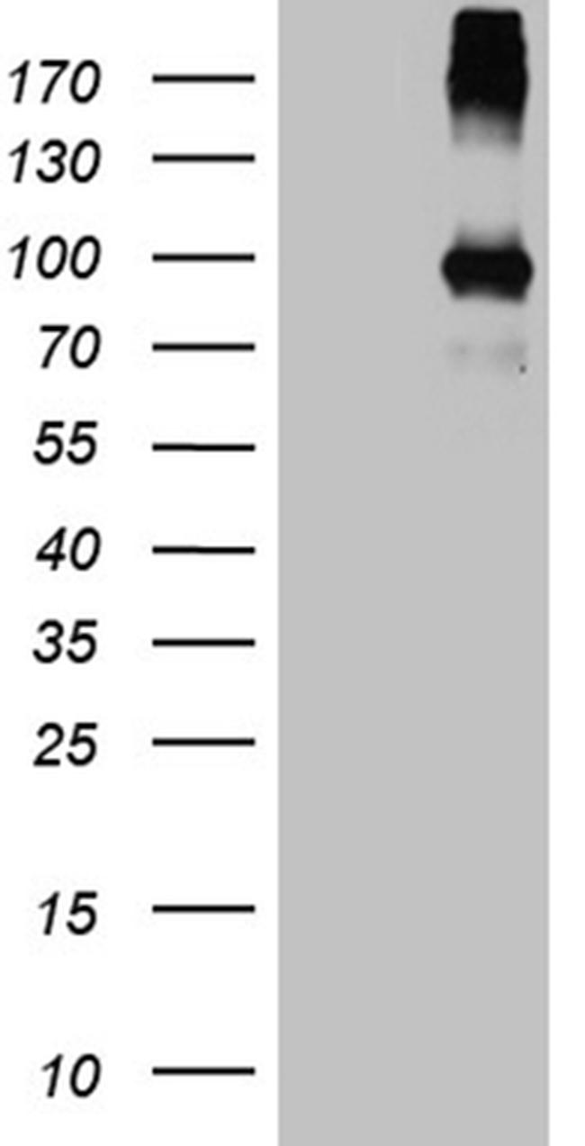 PAMR1 Antibody in Western Blot (WB)