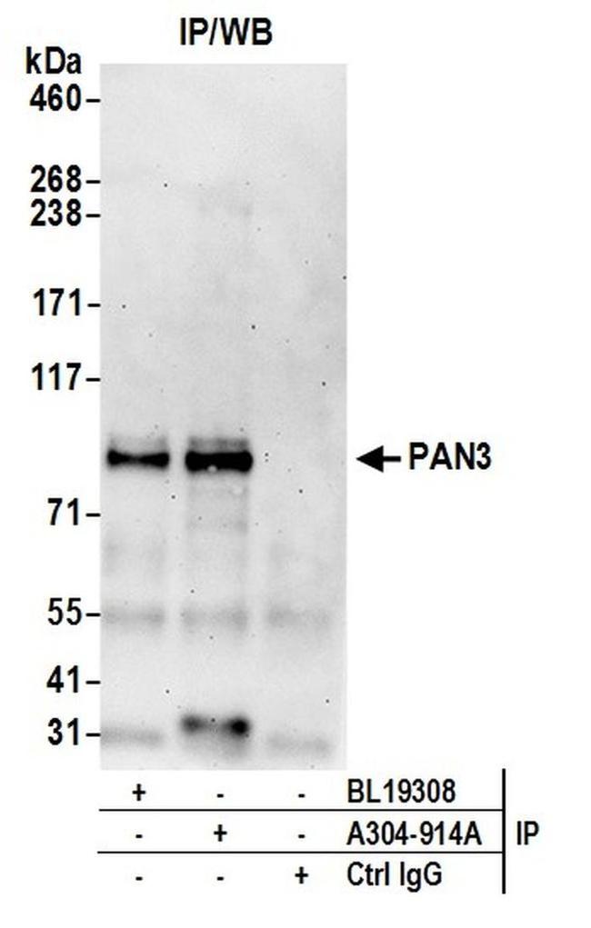 PAN3 Antibody in Western Blot (WB)