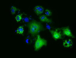 PANK2 Antibody in Immunocytochemistry (ICC/IF)