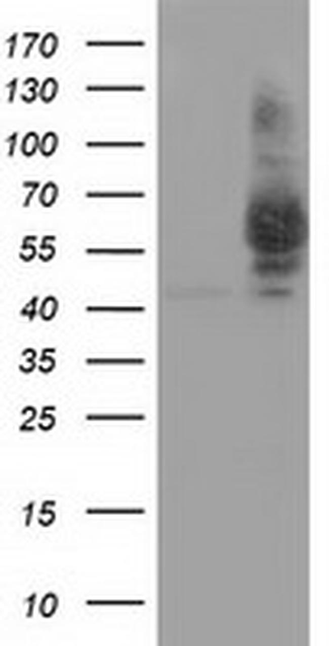 PANK2 Antibody in Western Blot (WB)