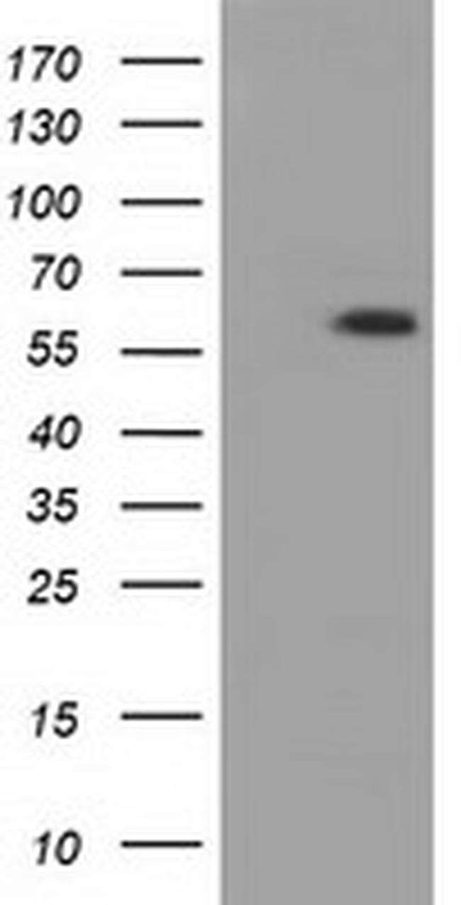 PANK2 Antibody in Western Blot (WB)