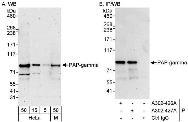 PAP-gamma Antibody in Western Blot (WB)