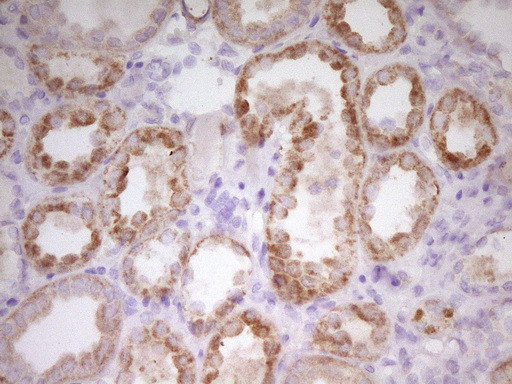 PAPSS2 Antibody in Immunohistochemistry (Paraffin) (IHC (P))