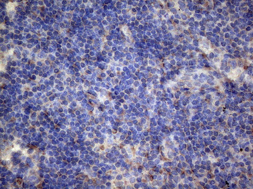 PAPSS2 Antibody in Immunohistochemistry (Paraffin) (IHC (P))