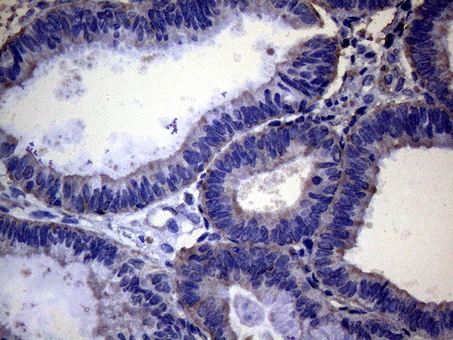 PAPSS2 Antibody in Immunohistochemistry (Paraffin) (IHC (P))