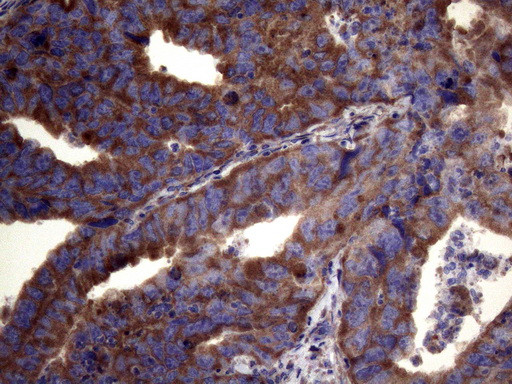 PAPSS2 Antibody in Immunohistochemistry (Paraffin) (IHC (P))