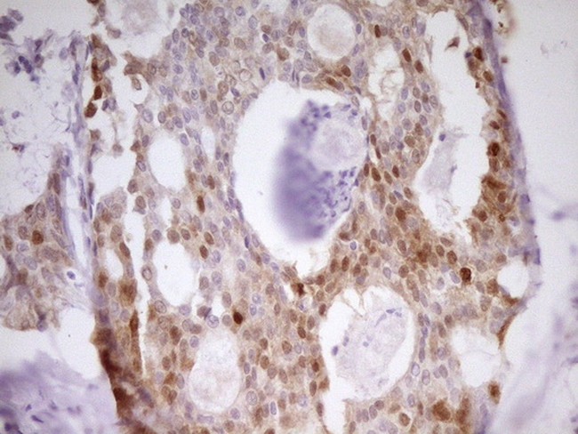 PAPSS2 Antibody in Immunohistochemistry (Paraffin) (IHC (P))