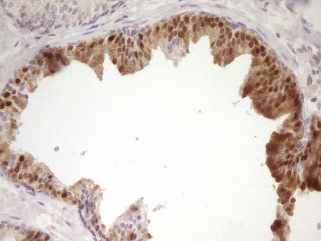 PAPSS2 Antibody in Immunohistochemistry (Paraffin) (IHC (P))