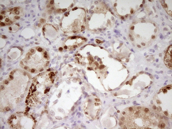 PAPSS2 Antibody in Immunohistochemistry (Paraffin) (IHC (P))