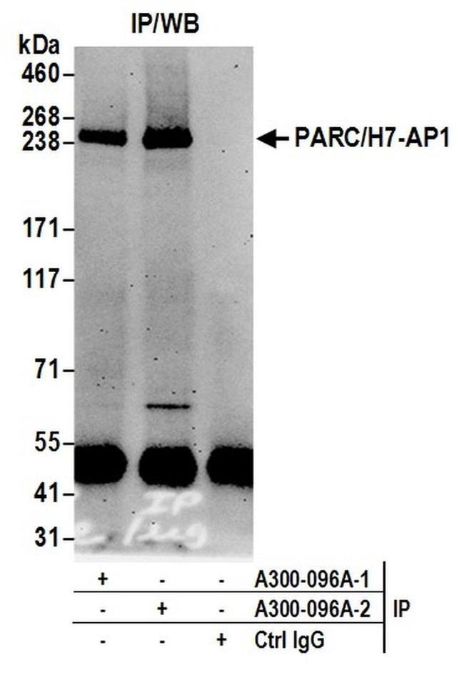 PARC/H7-AP1 Antibody in Western Blot (WB)