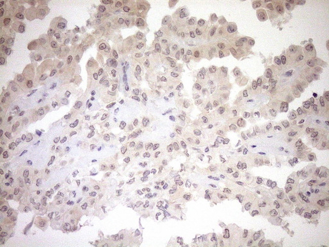 PARG Antibody in Immunohistochemistry (Paraffin) (IHC (P))