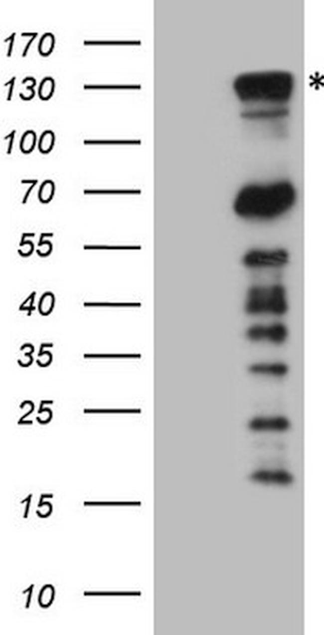 PARG Antibody in Western Blot (WB)