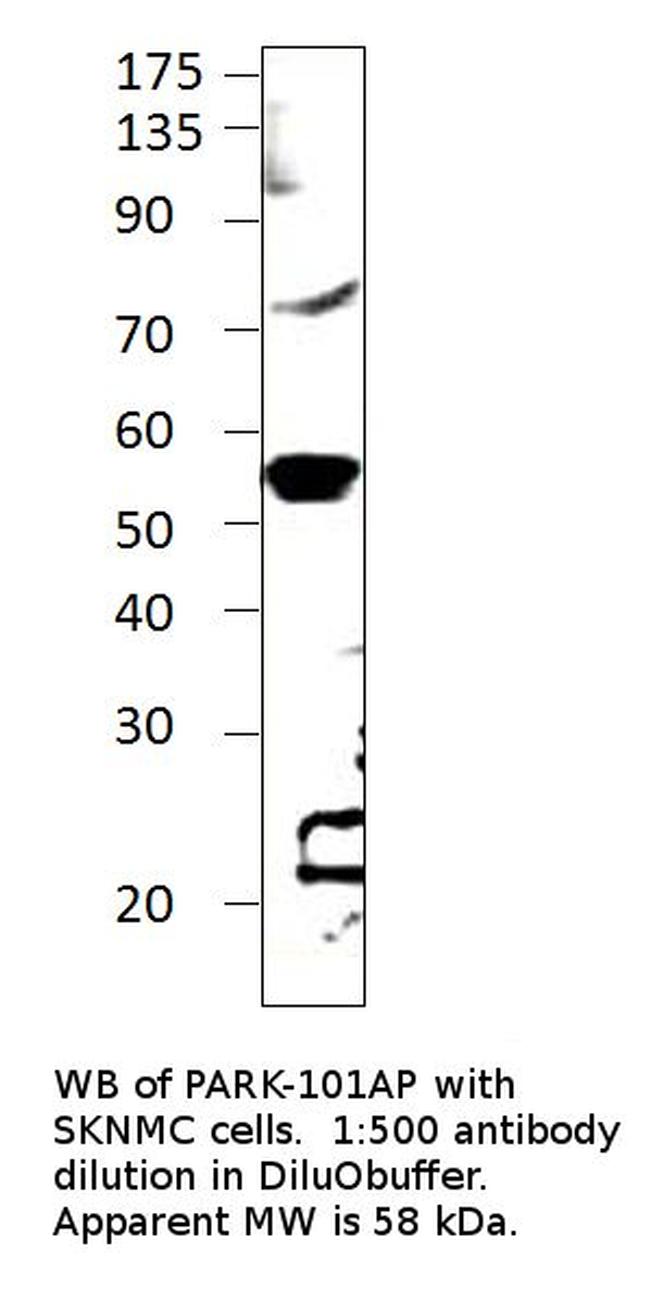 Parkin Antibody in Western Blot (WB)