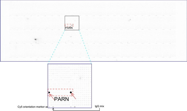 PARN Antibody in Peptide array (ARRAY)