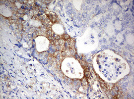 PARN Antibody in Immunohistochemistry (Paraffin) (IHC (P))