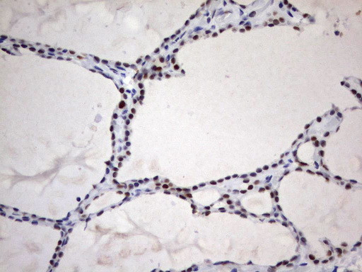 PARN Antibody in Immunohistochemistry (Paraffin) (IHC (P))