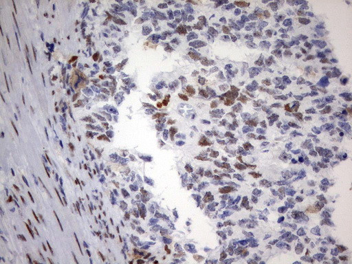 PARN Antibody in Immunohistochemistry (Paraffin) (IHC (P))